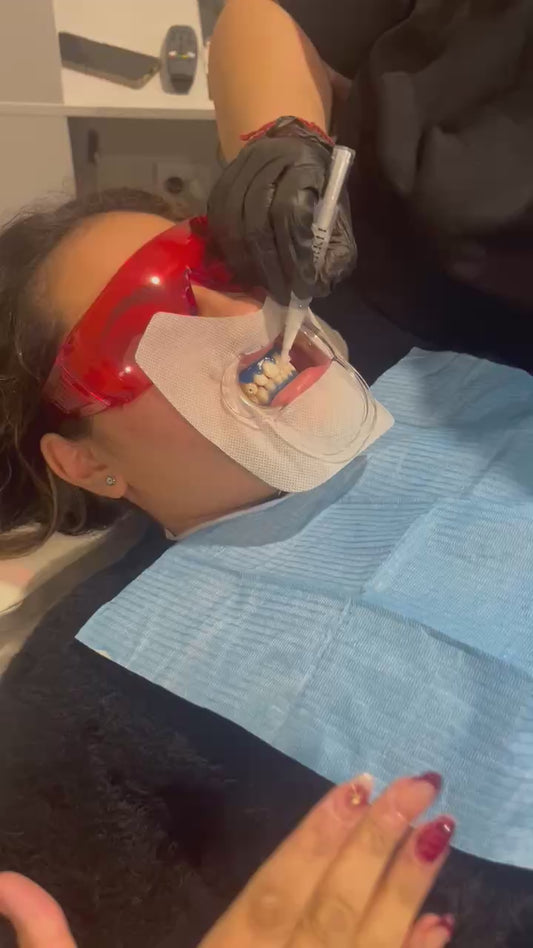 Teeth Whitening Triple Treatment ✨️